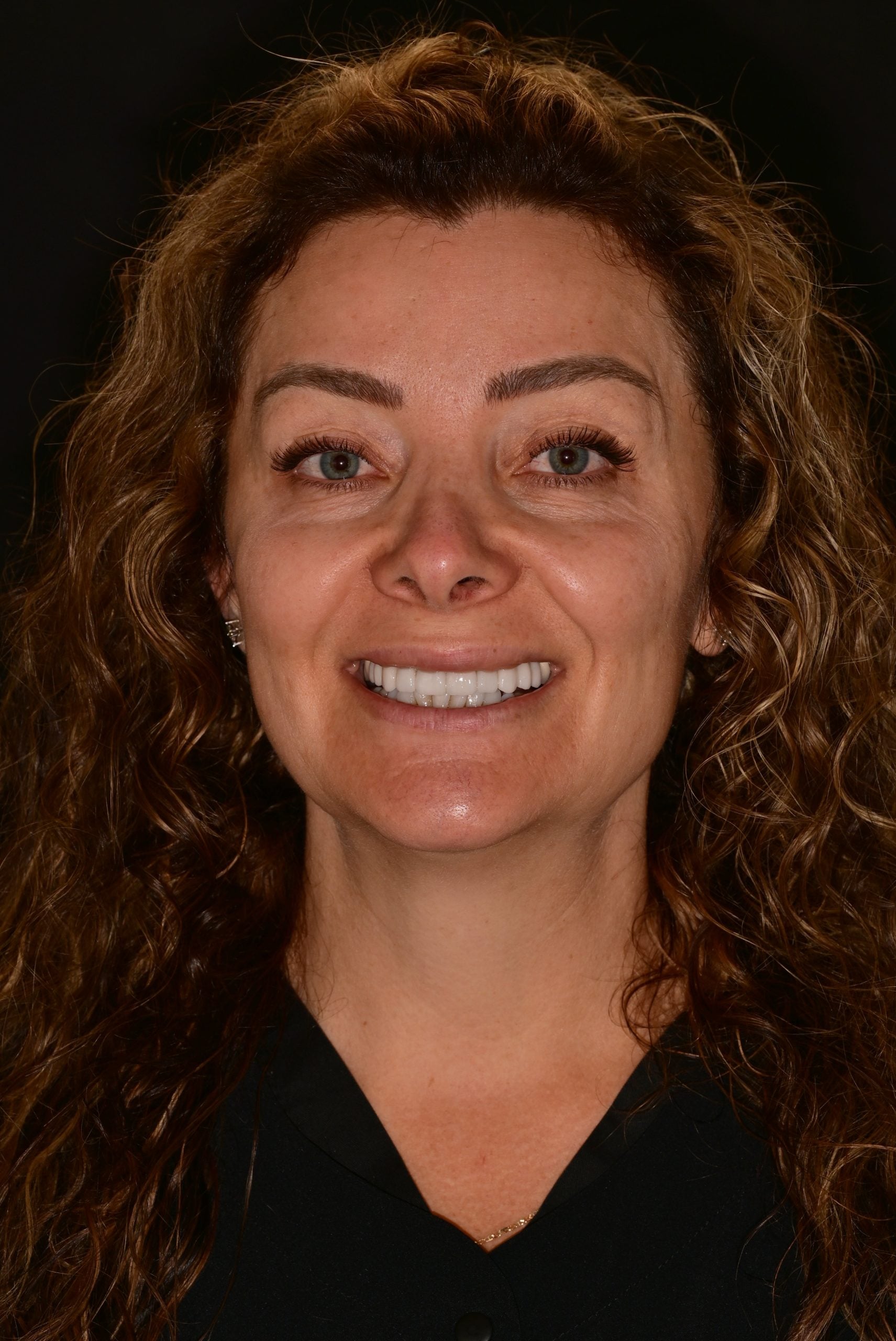 Klotilda - Dental Assistant - The Gentle Dentist, Shelby Township, MI