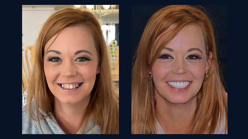 Tricia Smile Restoration